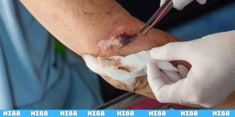 Khái niệm về giấc mơ bắn bị thương tâm linh liên quan đến các con số